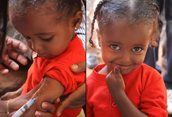 Measles Rubella