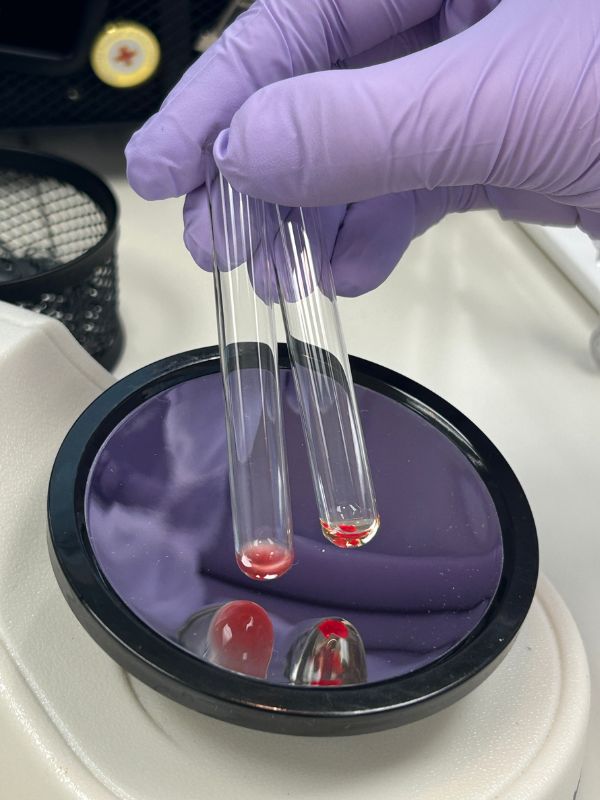 close-up blood collection sample