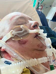 Diana Levesque in hospital bed with breathing tube.