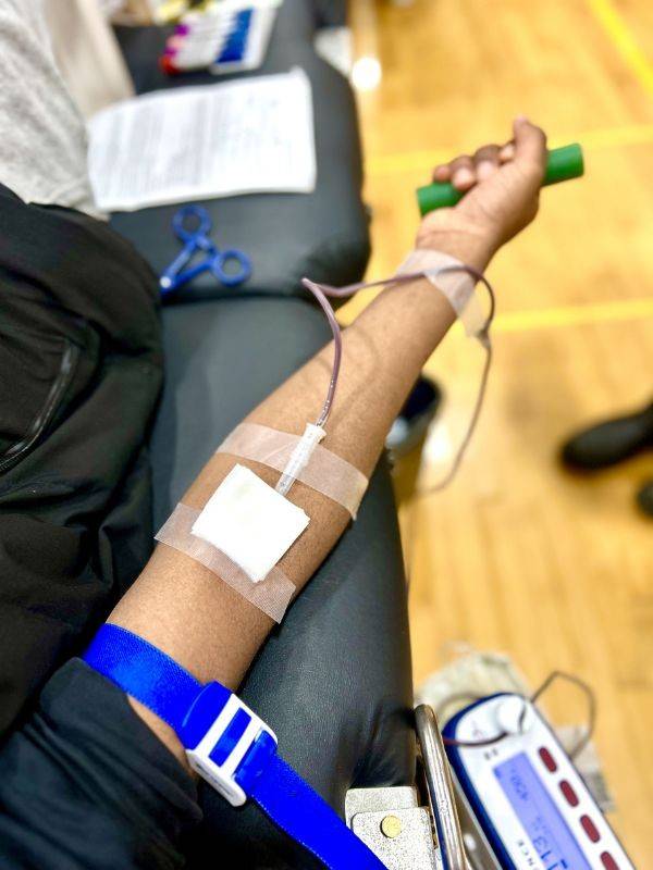 arm of young person donating blood