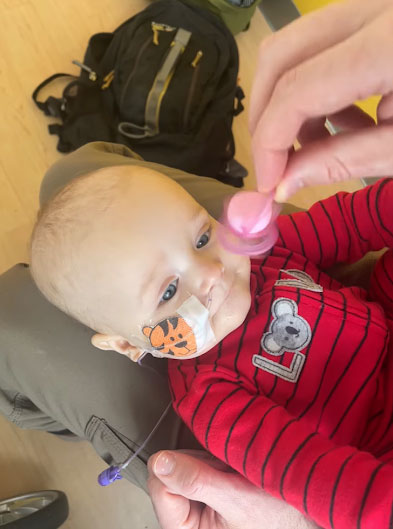 a baby, lying on the lap of a parent, with a bandage holding a tube in his nose.