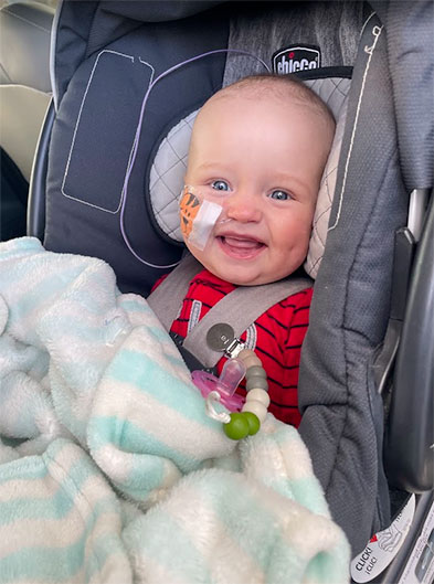 a baby, sitting in a car seat and smiling, with a bandage holding a tube in his nose.