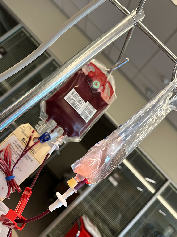 Blood bag hanging on a blood bag rack.
