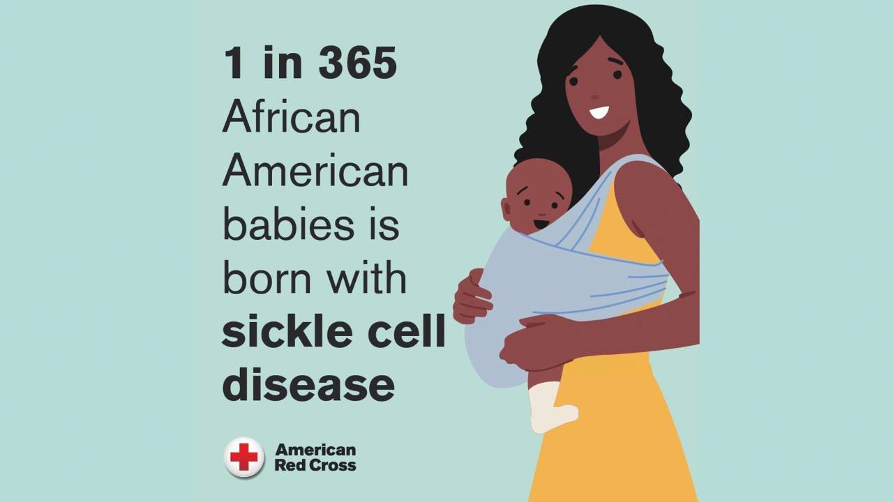 Graphic reads 1 in 365 African American babies is born with sickle cell disease