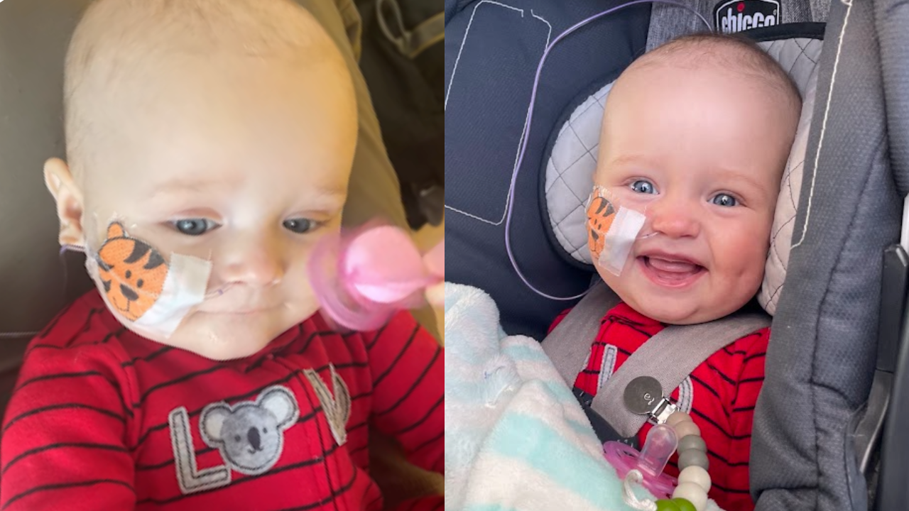 Side-by-side pictures of baby before and after blood transfusion
