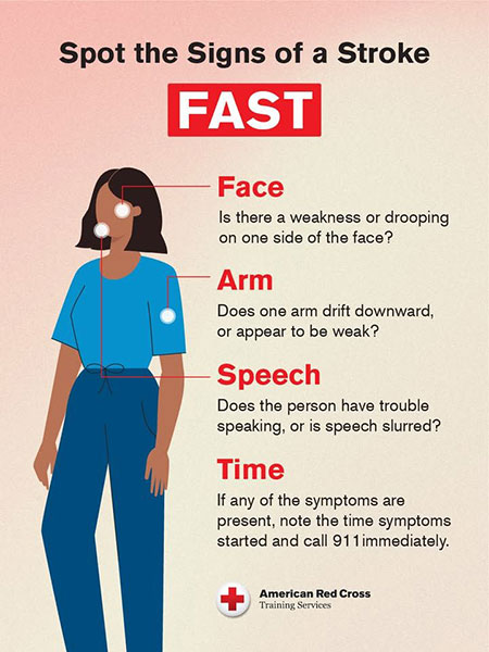 American Red Cross poster titled ‘Spot the Signs of a Stroke’ illustrating the FAST acronym: Face, Arm, Speech, and Time. An annotated person shows facial droop, a weak arm drifting downward, and slurred speech cues. The poster instructs to note when symptoms started and dial 911 immediately.