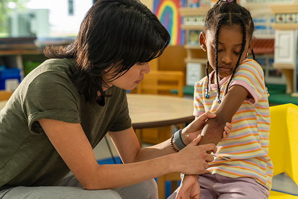 A Santa Rosa, California teacher inspects a scrape on a student's arm.